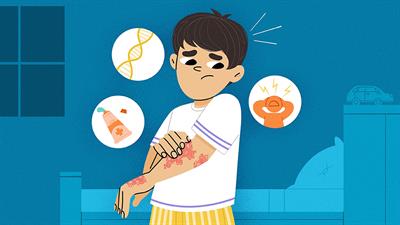 Psoriasis in Kids: What Every Child Should Know